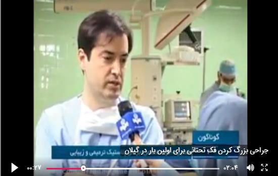 جراحی بزرگ کردن فک تحتانی برای اولین بار در گیلان توسط دکتر علیرضا فدایی نایینی فوق تخصص جراحی پلاستیک