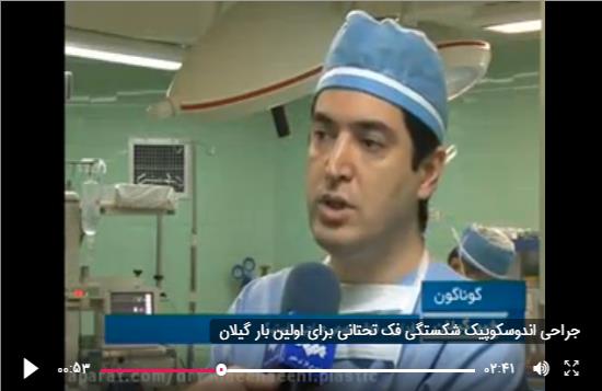 جراحی اندوسکوپیک شکستگی فک تحتانی برای اولین بار گیلان توسط دکتر علیرضا فدایی نایینی فوق تخصص جراحی پلاستیک