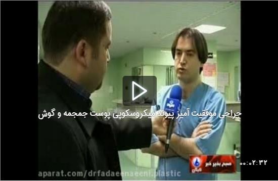 جراحی موفقیت آمیز پیوند میکروسکوپی پوست جمجمه و گوش