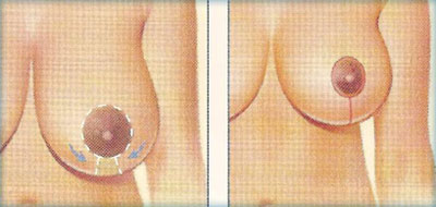 دکتر جراحی و زیبایی در رشت