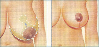 دکتر جراحی و زیبایی در گیلان