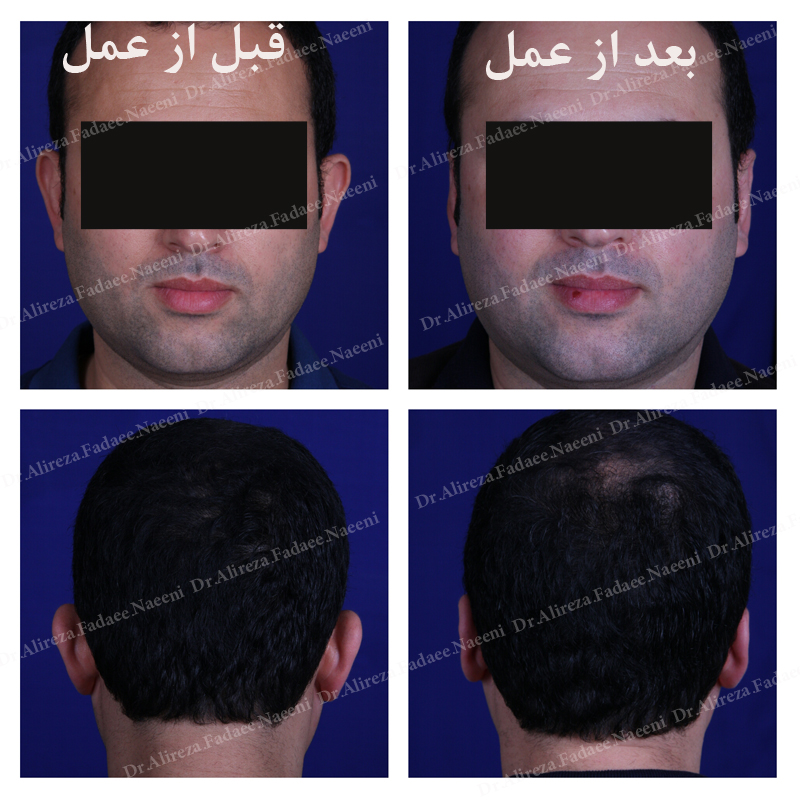 (گوش) دکتر علیرضا فدایی نایینی فوق تخصص جراحی پلاستیک