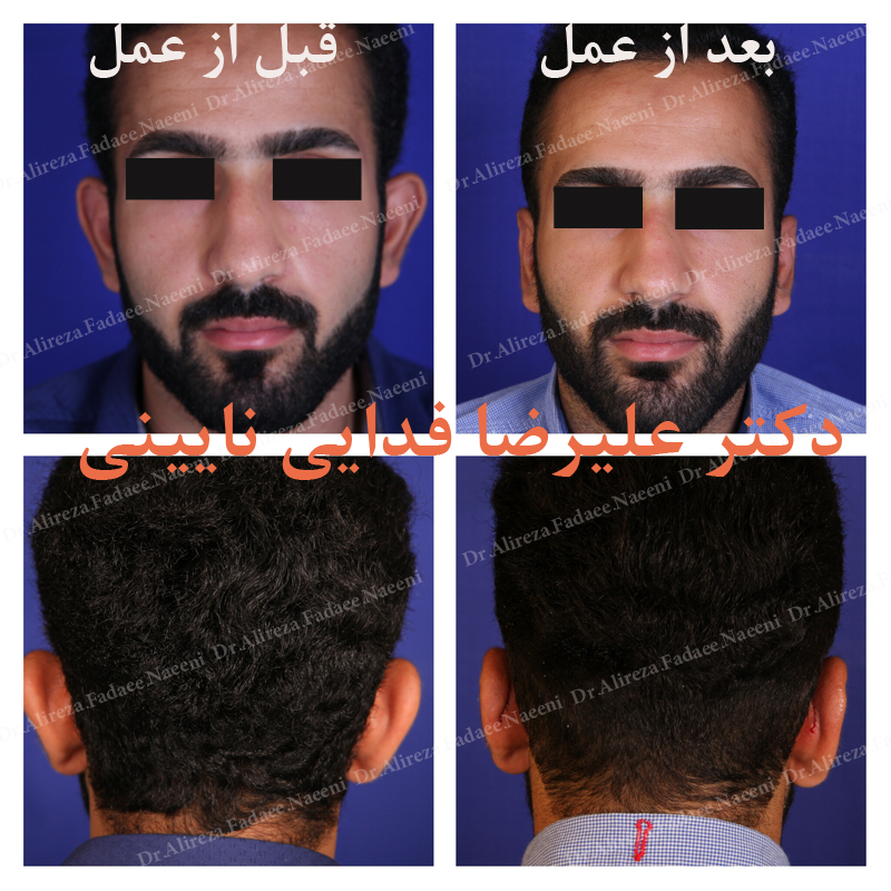 (گوش) دکتر علیرضا فدایی نایینی فوق تخصص جراحی پلاستیک